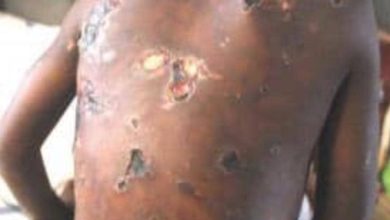 A seven-year-old boy, Benedicto Albert was beaten by his father, a policeman, Albert Benedicto in Simiyu Region, Tanzania