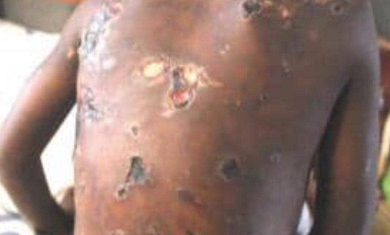 A seven-year-old boy, Benedicto Albert was beaten by his father, a policeman, Albert Benedicto in Simiyu Region, Tanzania